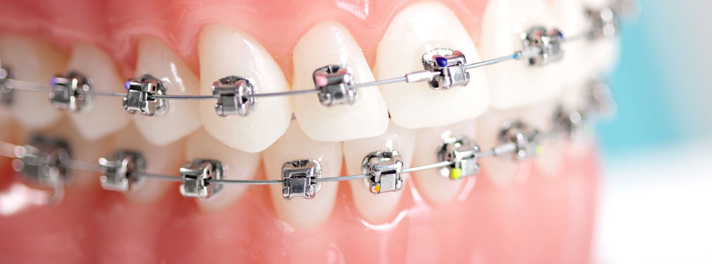 Ortodonti Kliniği